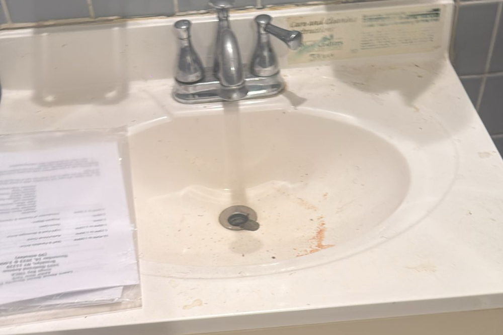 Stained dirty sink with soap scum and grime before professional bathroom cleaning